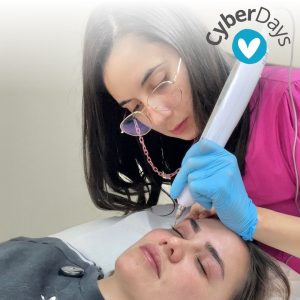 BLEFAROPLASMA DE PÁRPADOS