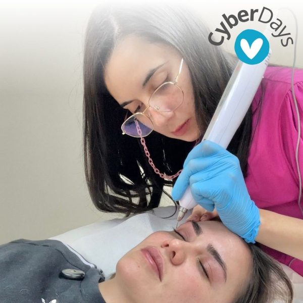 BLEFAROPLASMA DE PÁRPADOS